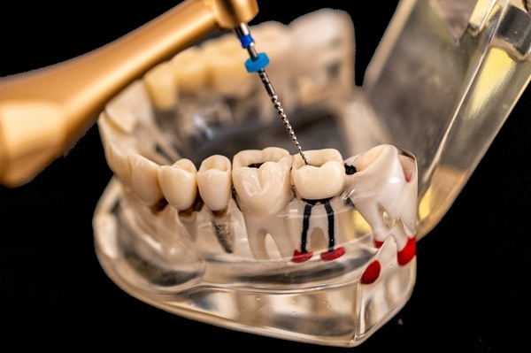 Relieving Pain At An Endodontist Near Me