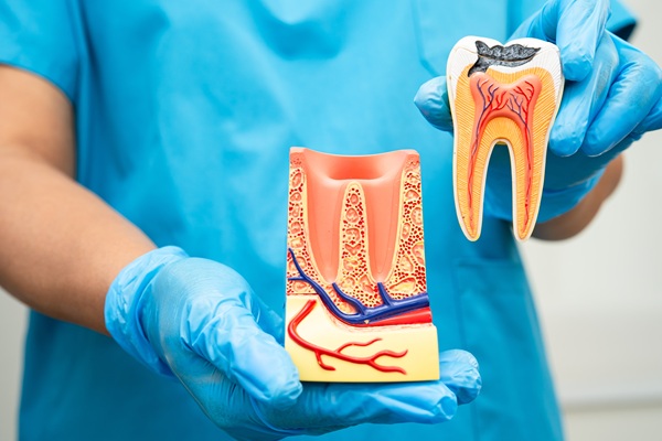 Signs You Are A Candidate For Non Surgical Root Canal Therapy