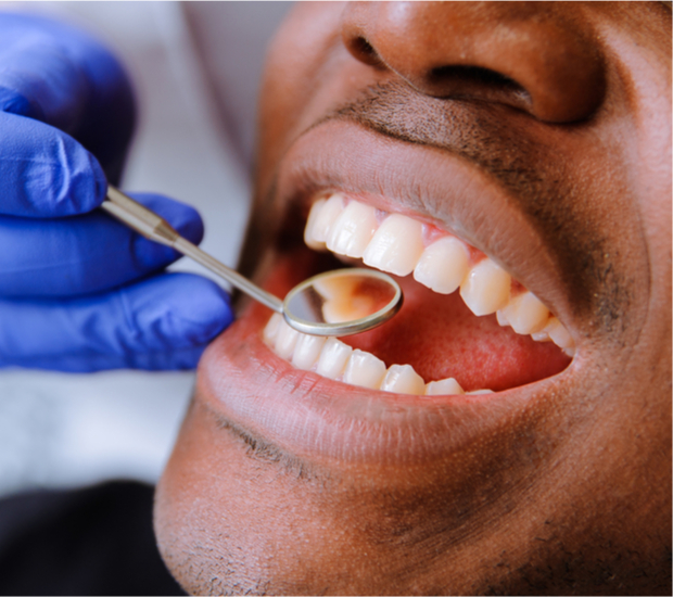 Nashville Root Canal Treatment